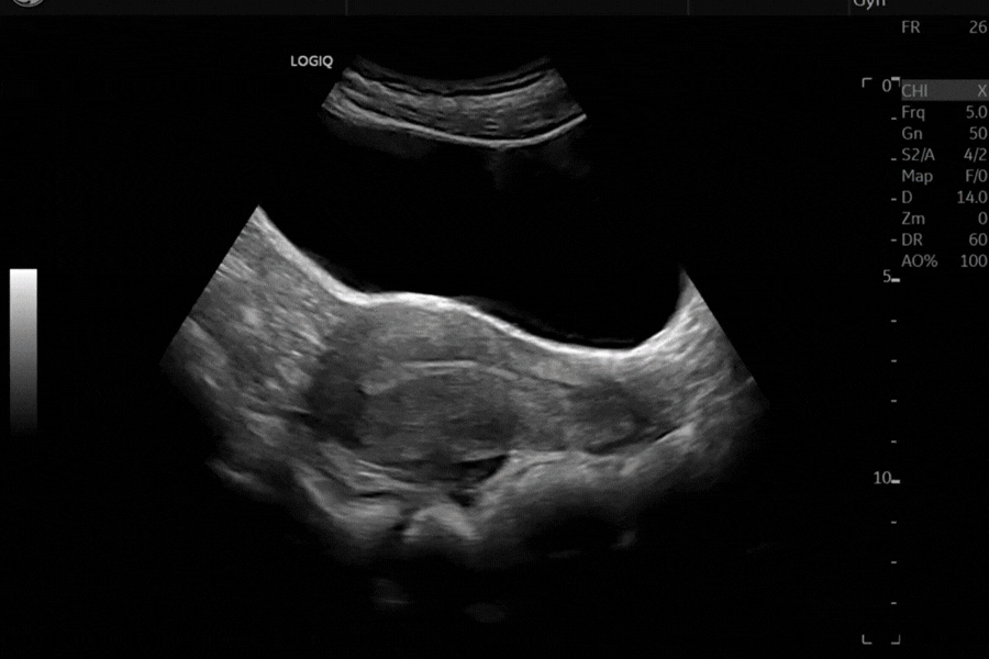 Versatile ultrasound - specialized for your care area